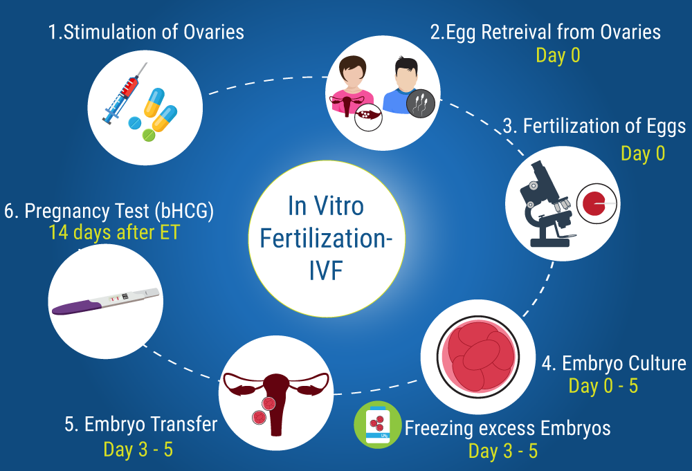 In Vitro Fertilization