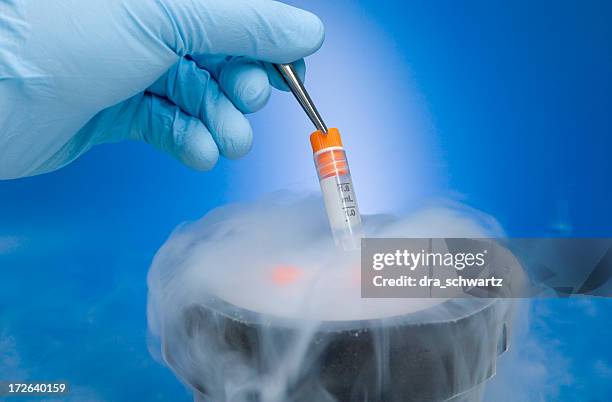 Egg Freezing