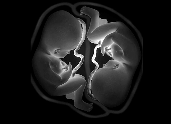 High-Risk Pregnancy Care